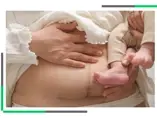 Cesarskie cięcie, a mikrobiota noworodka Brzuch kobiety po porodzie z widoczną kresą ciemną, trzymającej niemowlę