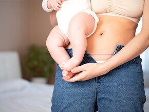 dziecko na rękach u mamy z odsłoniętą blizną po cięciu cesarskim