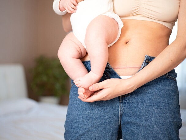 dziecko u mamy na rękach z odsłoniętą blizną po cięciu cesarskim