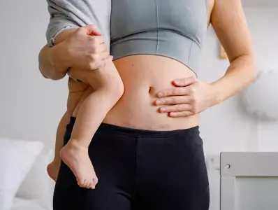 Kobieta trzymająca dziecko pokazująca brzuch z blizną po cesarskim cięciu Kobieta trzymająca dziecko pokazująca brzuch z blizną po cesarskim cięciu